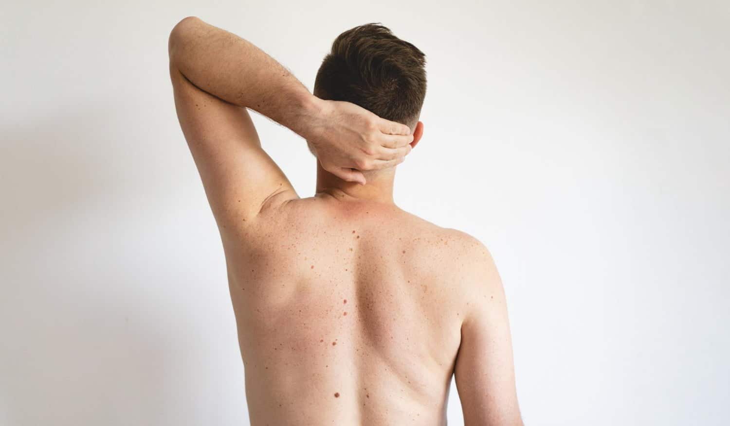 Déceler les 5 signes les plus surprenants d’un cancer de la peau