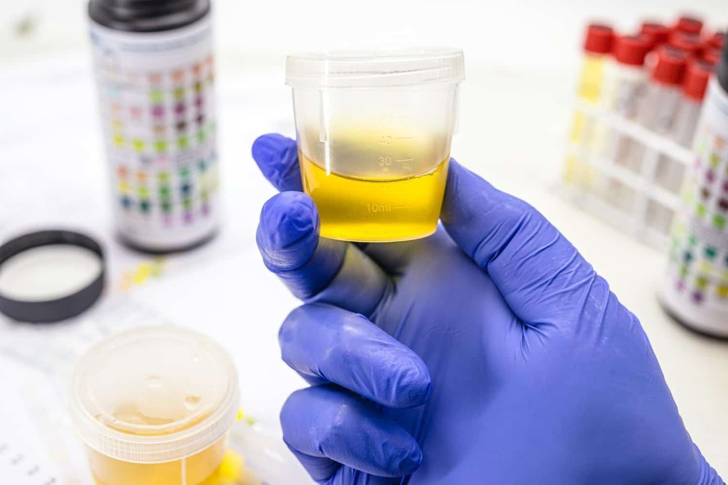Oligoéléments : les bénéfices du zinc pour la santé, où en trouver dans l’alimentation