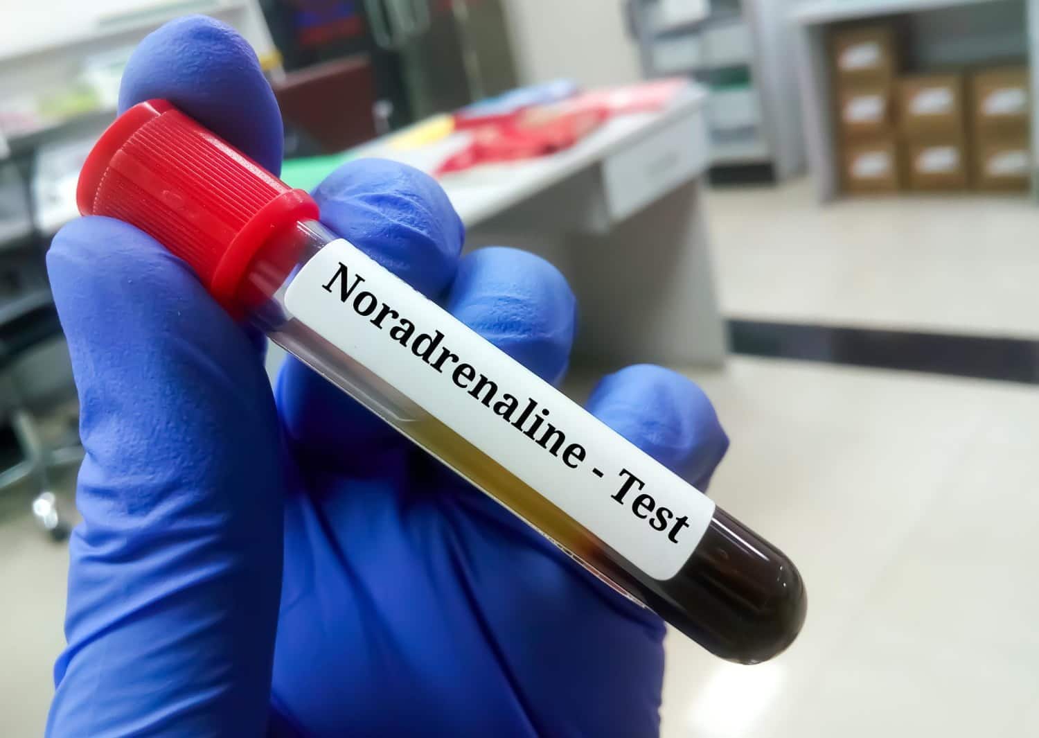 NORADRÉNALINE : Le neurotransmetteur du tonus!