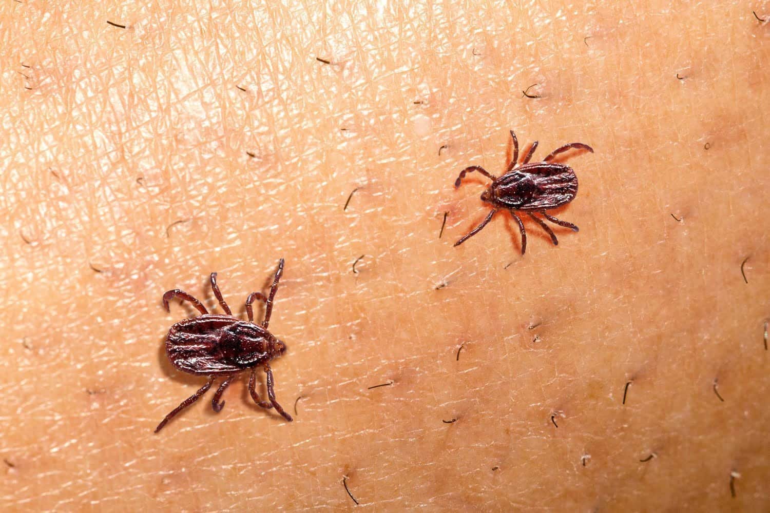 BORRÉLIOSE DE LYME, LES RAVAGES SILENCIEUX DES BACTÉRIES BORRÉLIES