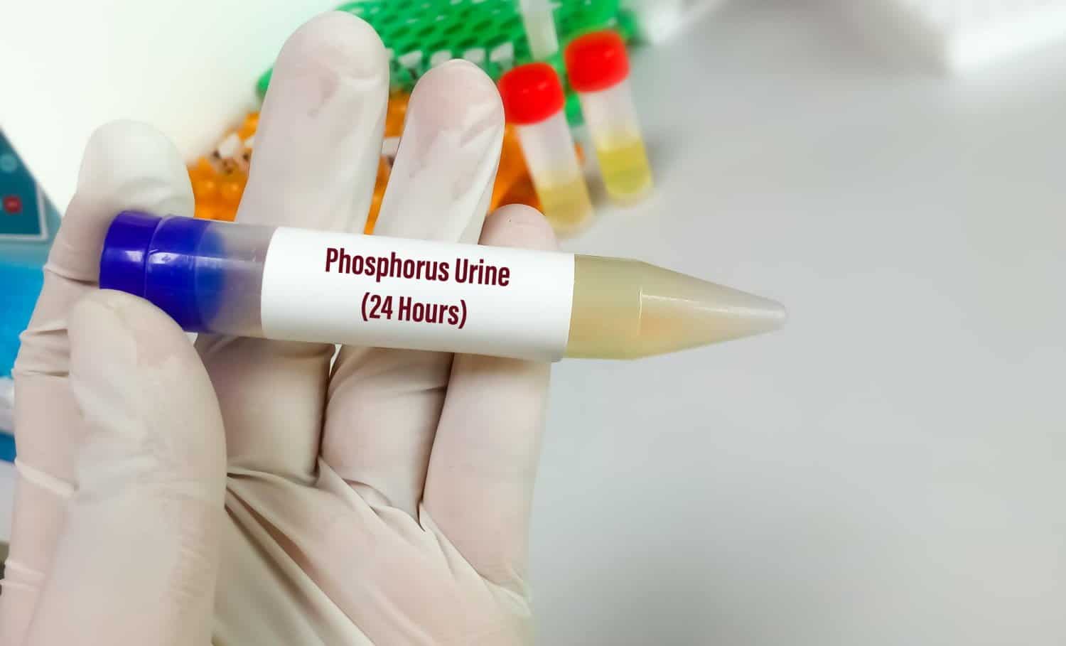 Phosphoric acidum : pour les jeunes adultes saturés et épuisés