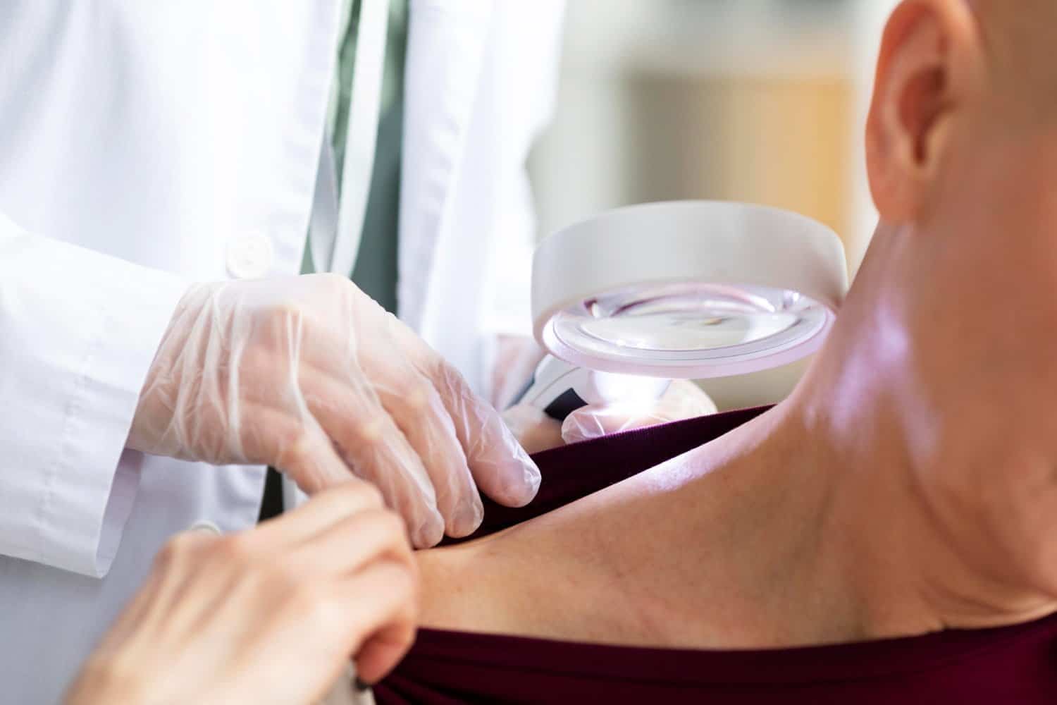 Acné, eczéma, psoriasis : aborder les problèmes de peau avec la naturopathie