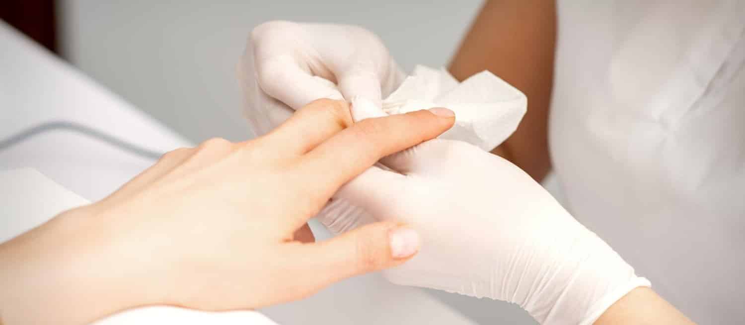 Comment soigner le panaris au naturel ?
