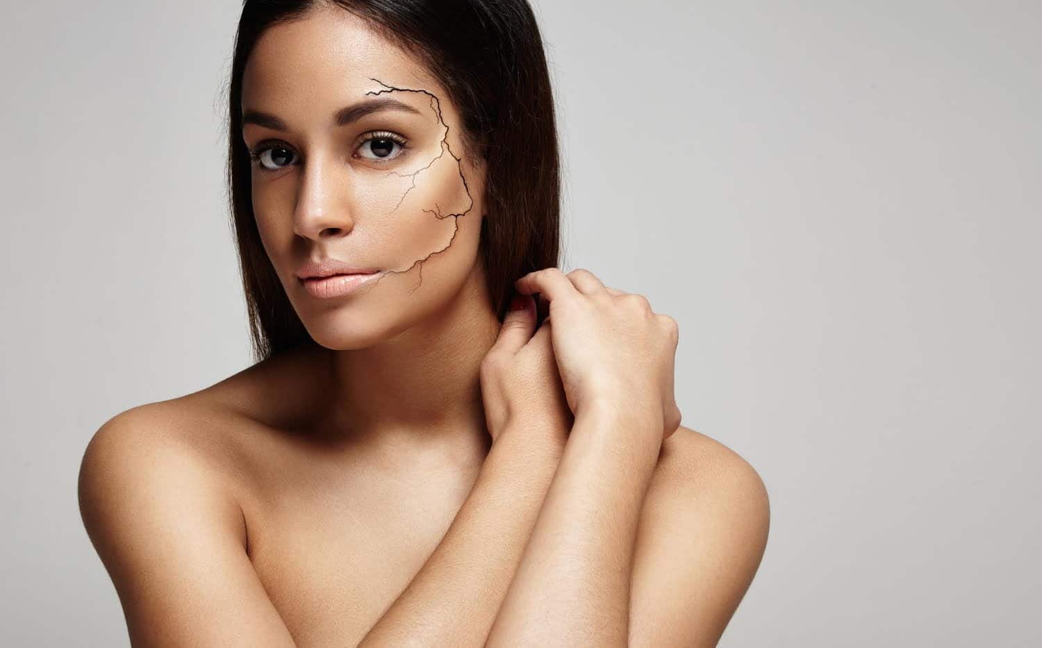 Peau sèche ou peau de « croco », comment y faire face en hiver ?