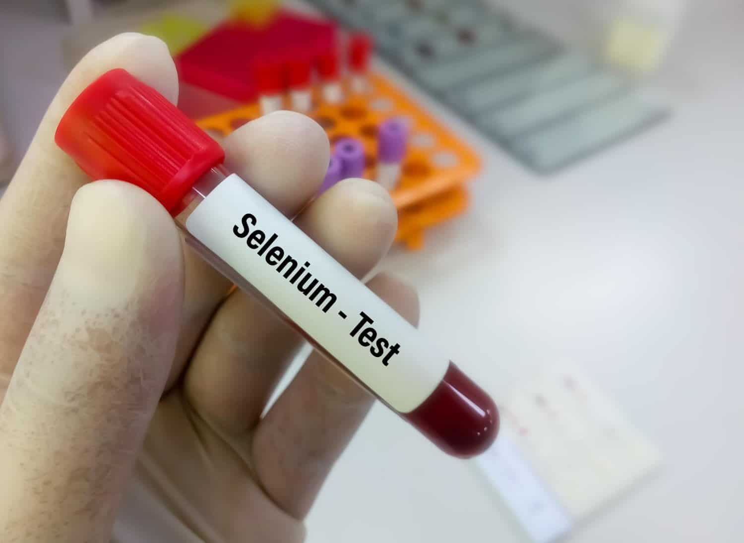 Selenium : une souche homéopathique pour le soutien du métabolisme