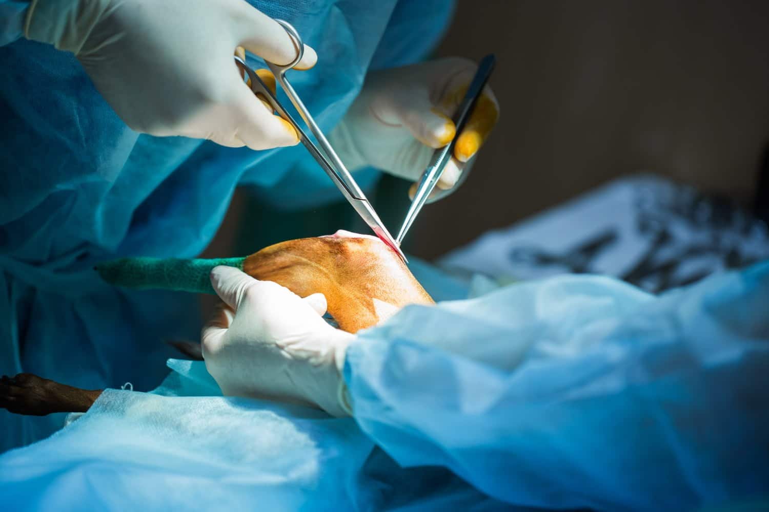 6 cas incroyables et vrais d’auto-chirurgie. Vous pourriez vous opérer vous-mêmes?