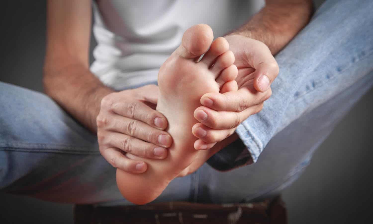 Le pied d’athlète : les signes courants et 4 remèdes maison