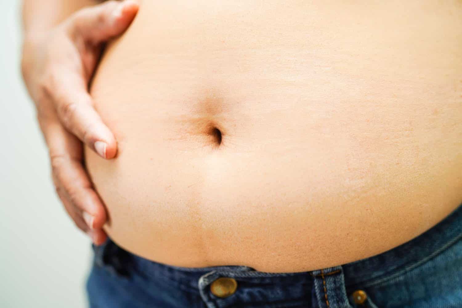 Obésité et insuffisance cardiaque : maigrir peut aider le cœur