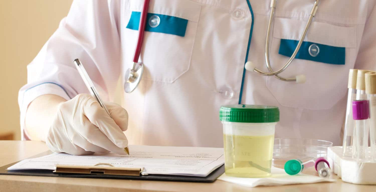 Urine qui sent le café: causes courantes, signes d’alerte, solutions