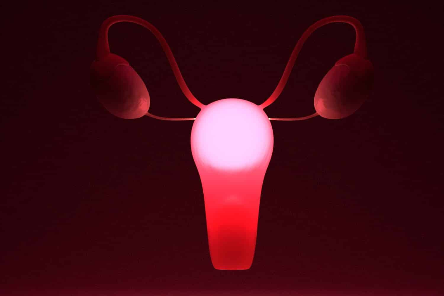 Syndrome des ovaires polykystiques : symptômes, causes et complications