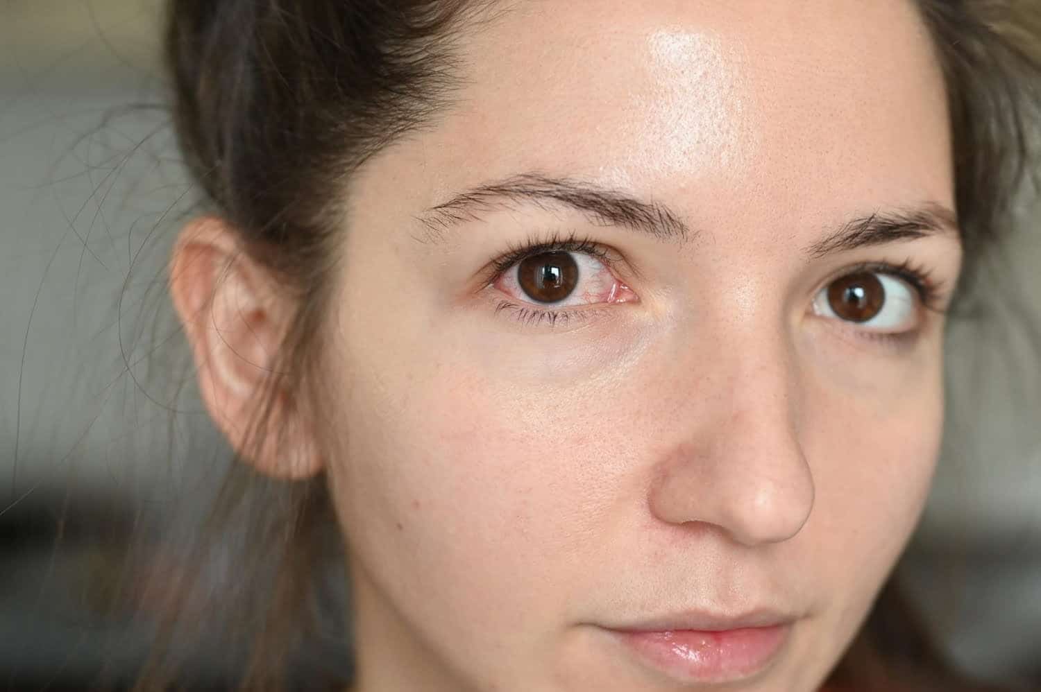 Pourquoi a t-on les yeux secs en hiver, comment le traiter