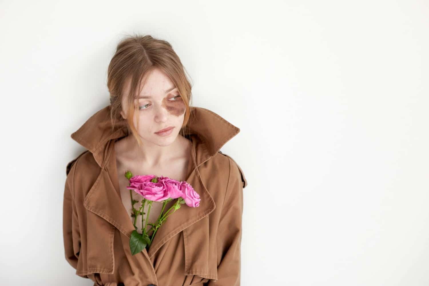Hyperpigmentation: comment atténuer les tâches sur la peau et mélasme