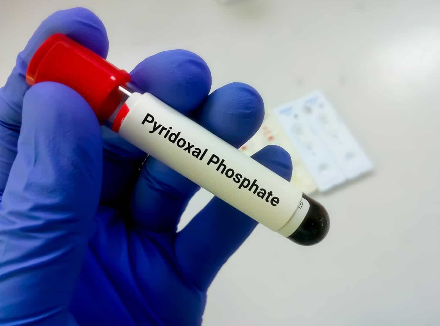 Danger des additifs alimentaires : les phosphates attaquent