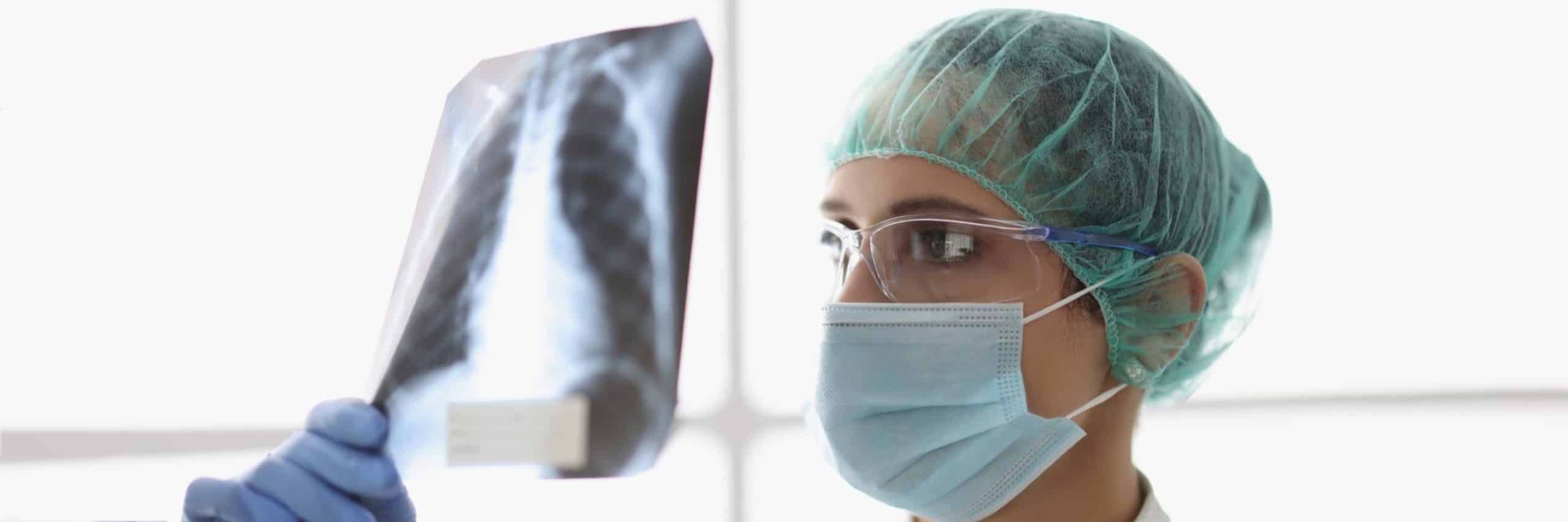 De 20 à 40 ans pour qu’apparaisse un cancer du poumon