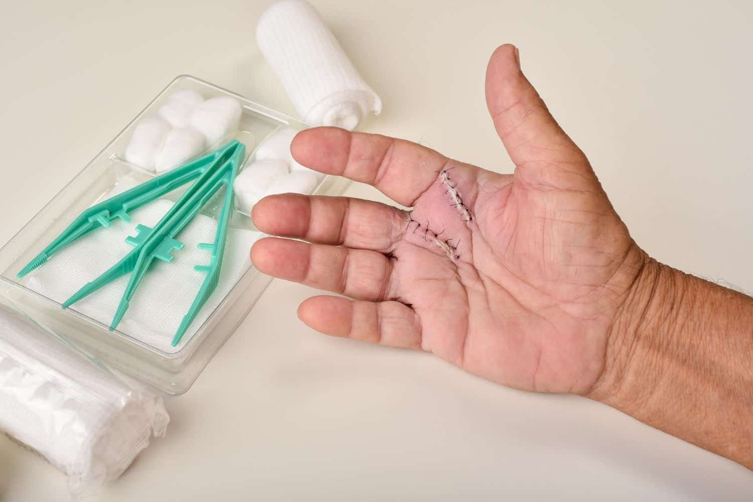 Causes de la raideur des doigts et astuces pour la soulager