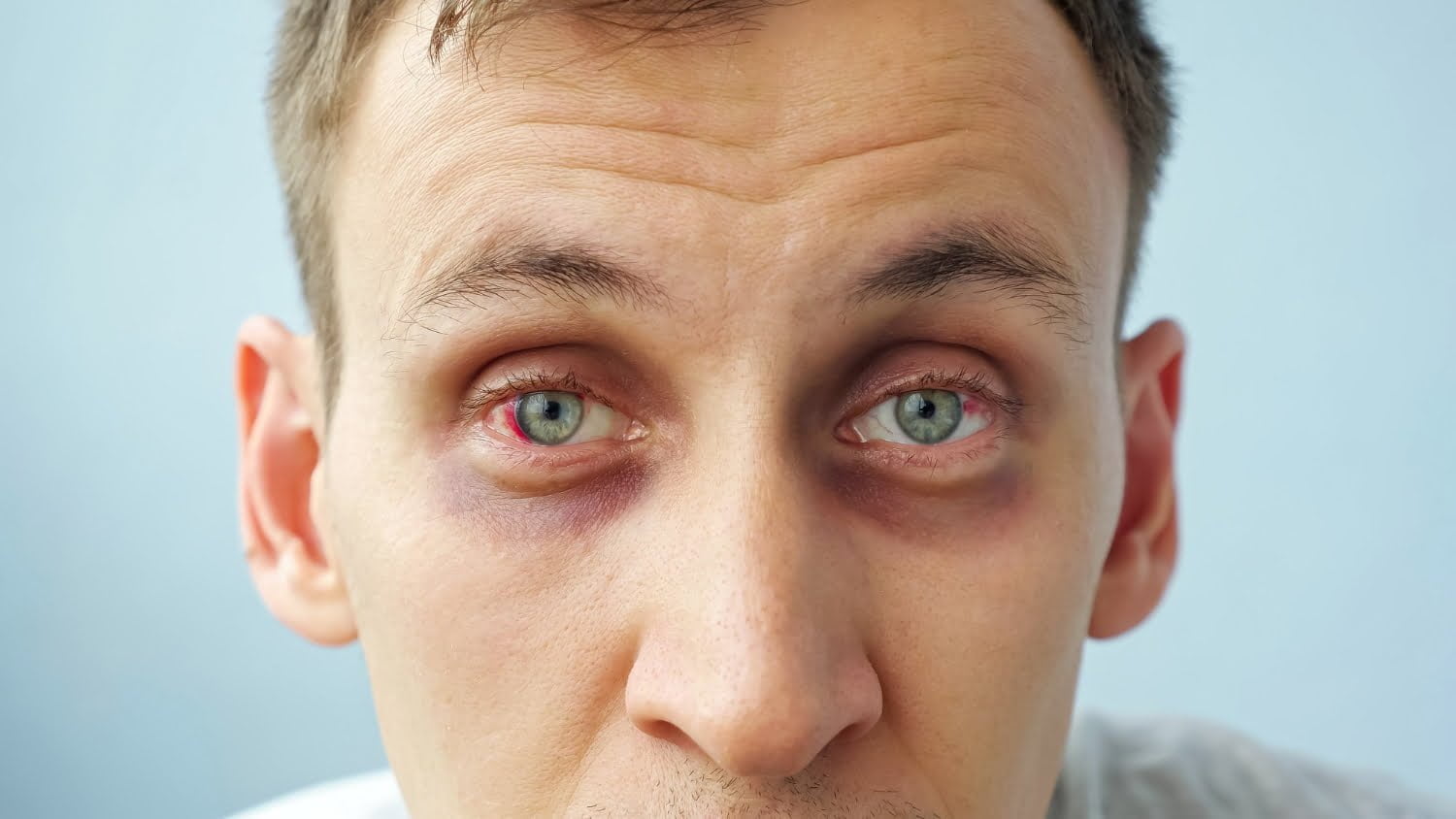 Sécheresse oculaire: que faire pour retrouver la larme à l’oeil