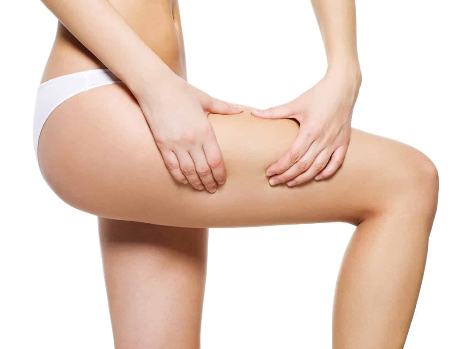 Comment venir à bout naturellement de la cellulite