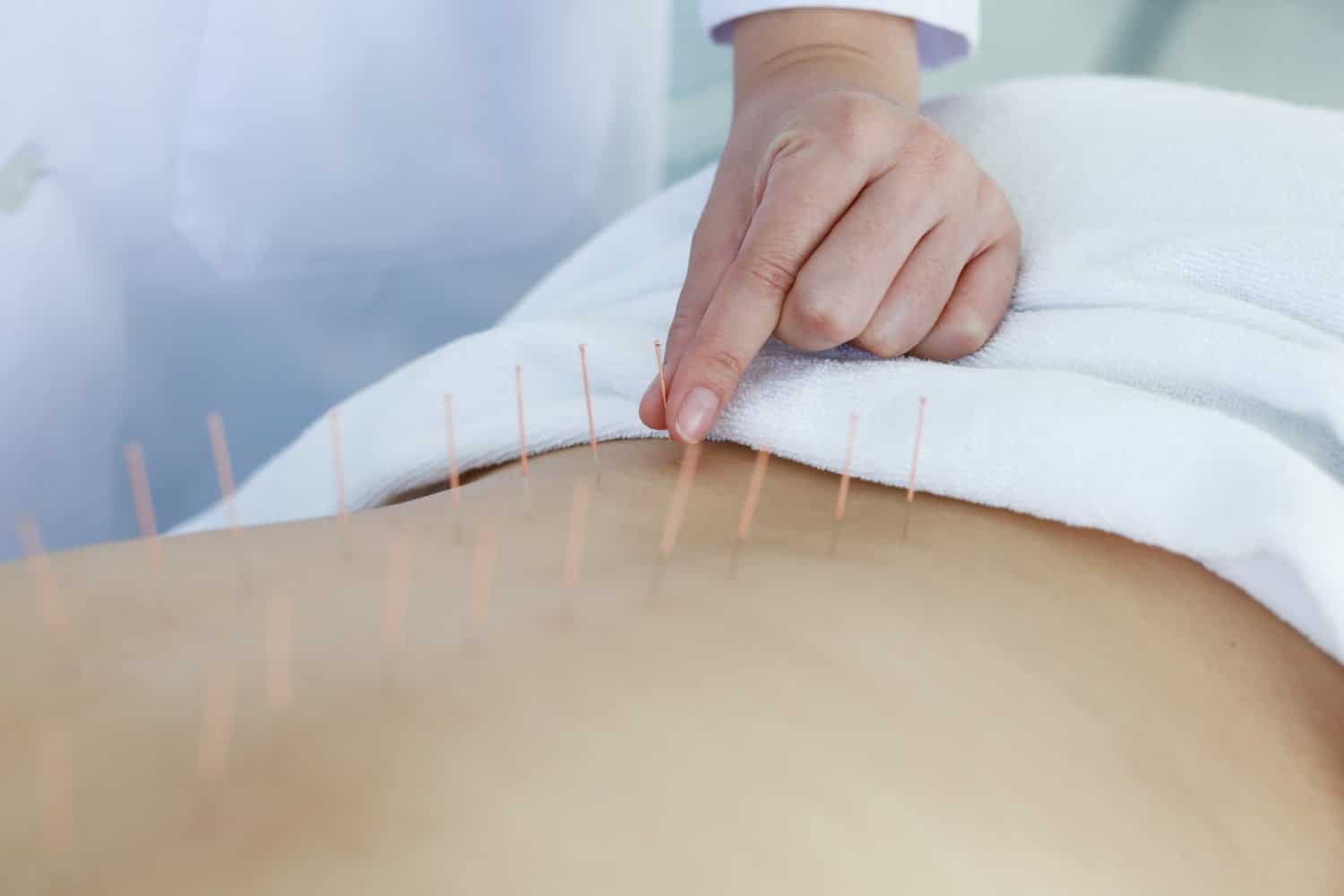 Canal carpien: l’acupuncture fait ses preuves pour soulager les symptômes