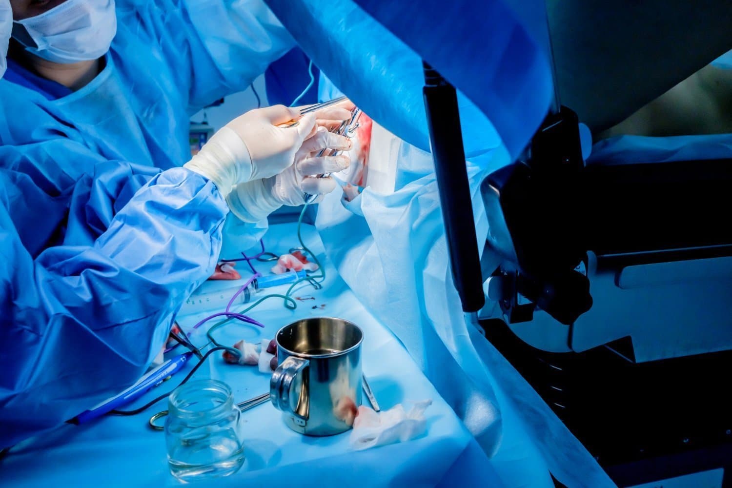 Cancer colorectal: perdre du poids pour réduire le risque par deux