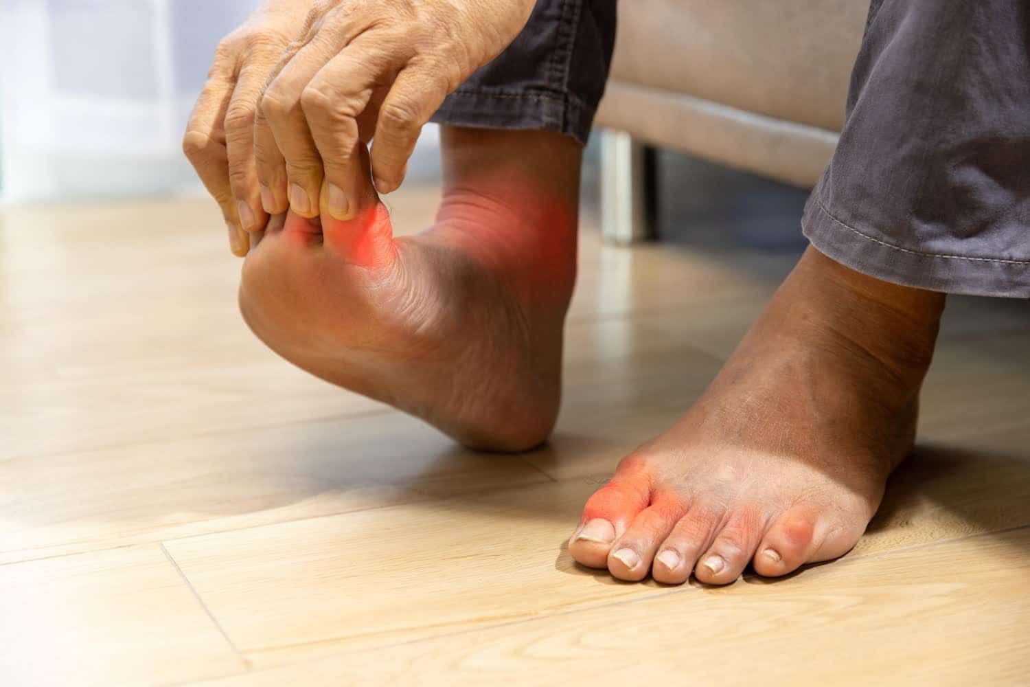 Infarctus, AVC: deux fois plus de risques en cas de goutte