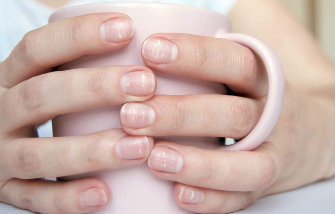 Demi-lunes sur les ongles : ce que révèlent vos ongles sur votre santé 
