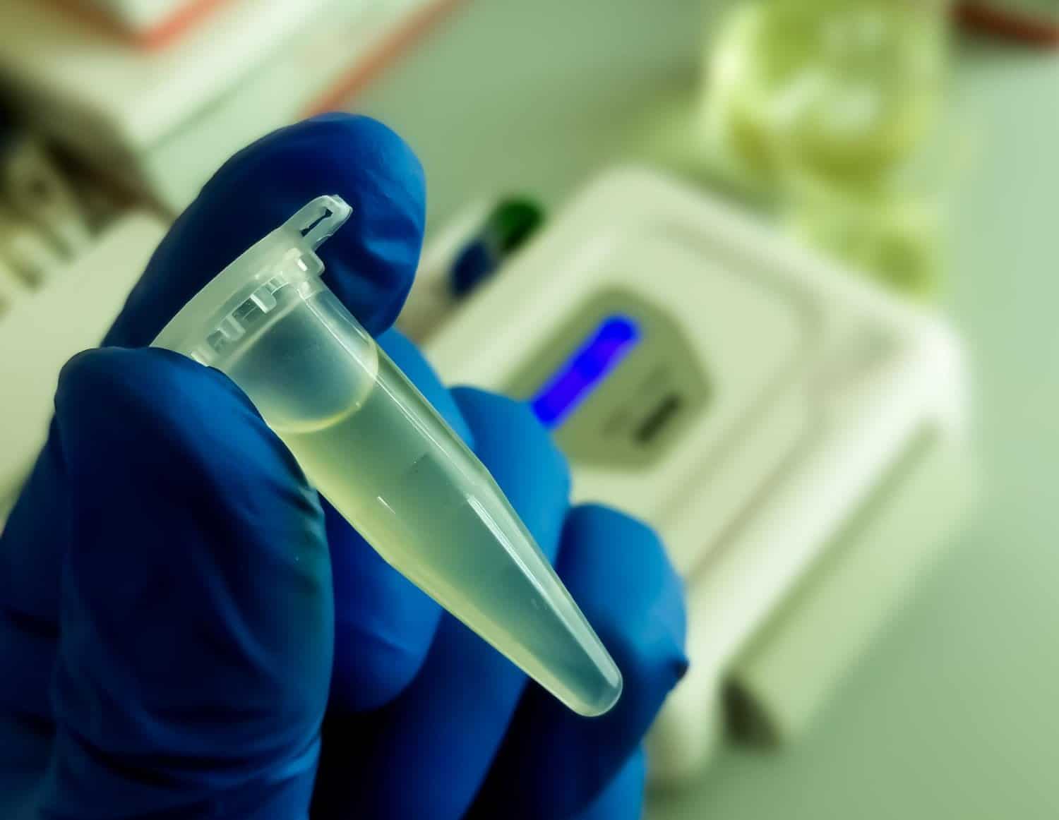 Vitamine D et poids de santé protègent de la sclérose en plaques