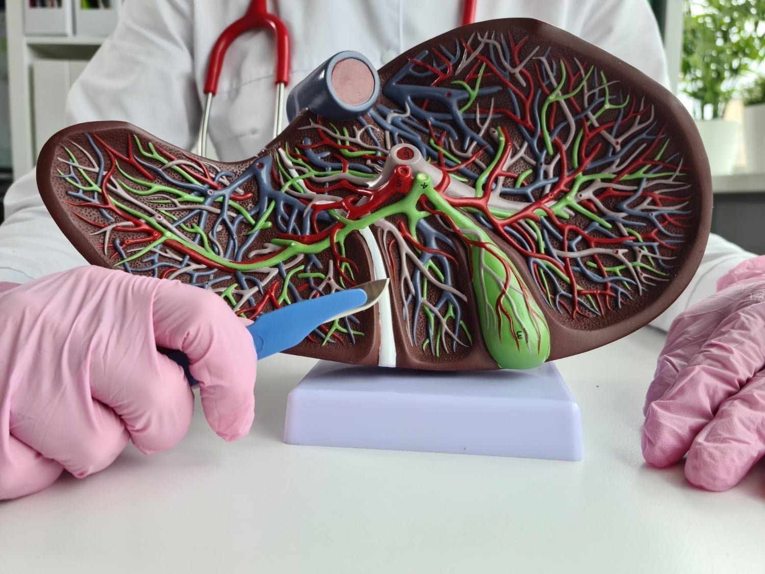 Métastases au foie : Symptômes, diagnostic et perspectives
