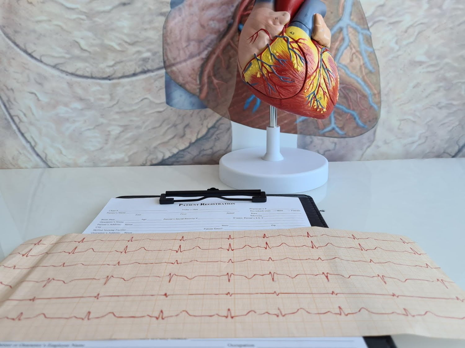 Tachycardie: causes et prévention du coeur qui s’emballe