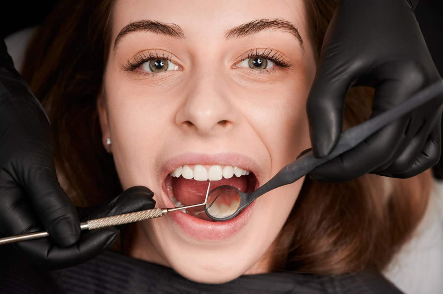 Jaunissement des dents : 10 motifs étonnants de cette coloration