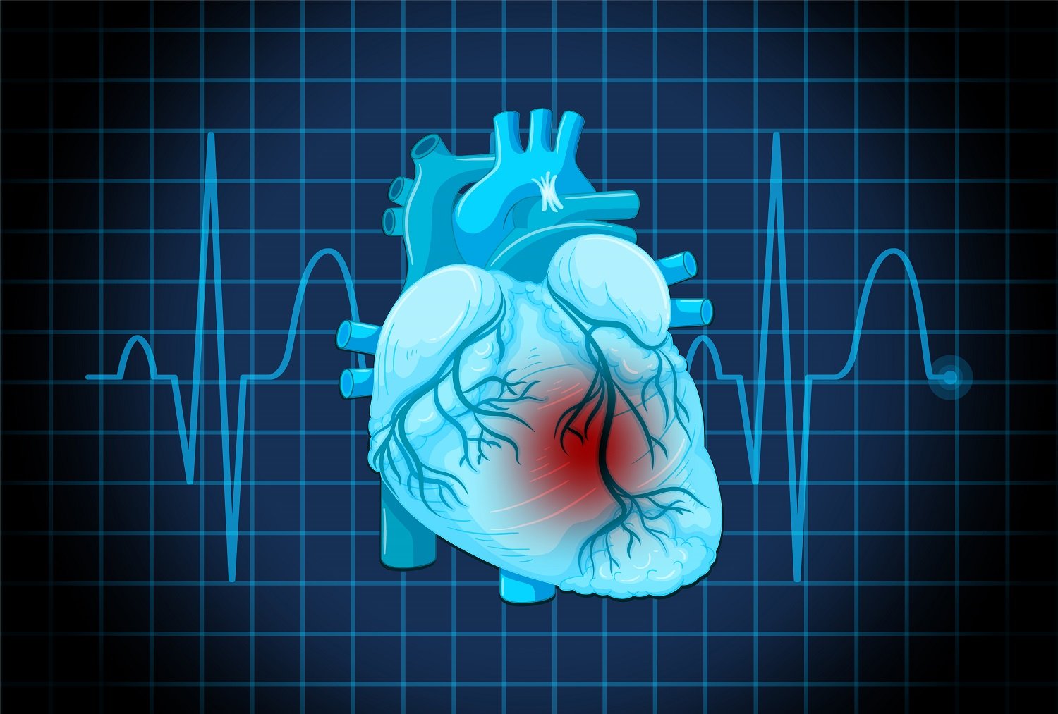 Les signes physiques surprenants de maladie cardiaque