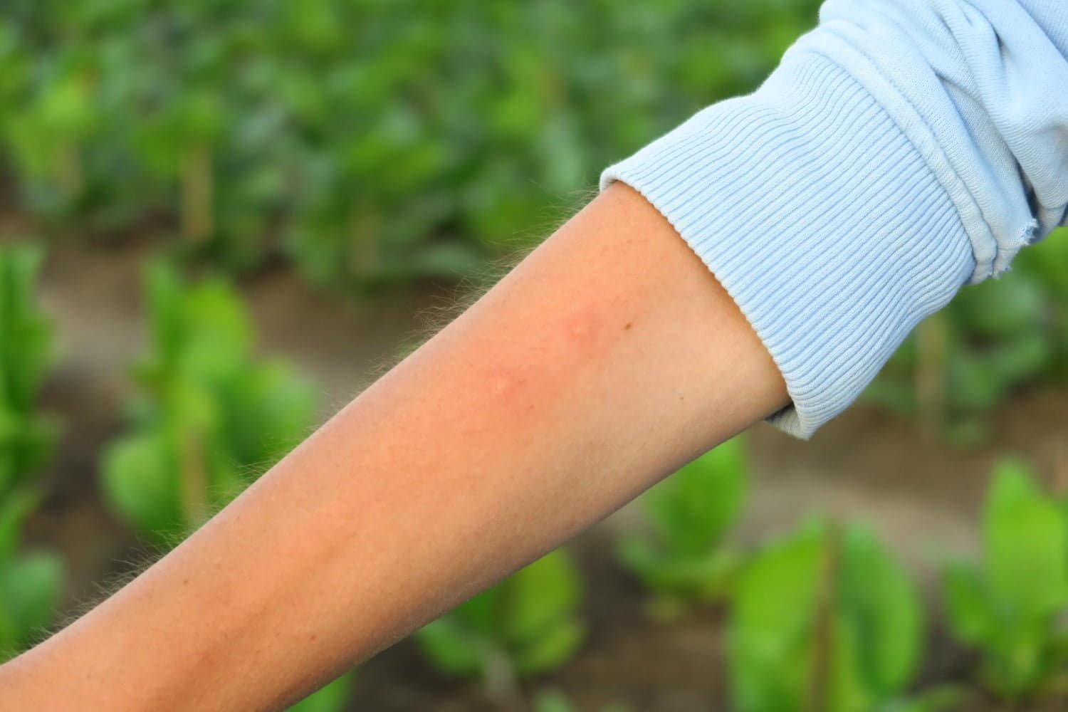 Piqure d’insecte : comment savoir ce qui m’a piqué et si c’est dangereux