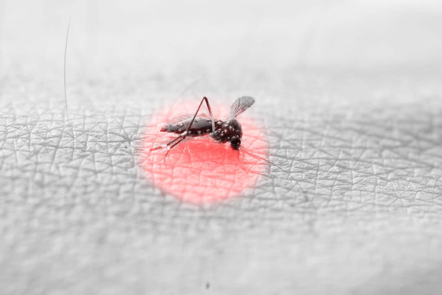 Pourquoi les piqûres de moustiques démangent-elles et comment les apaiser