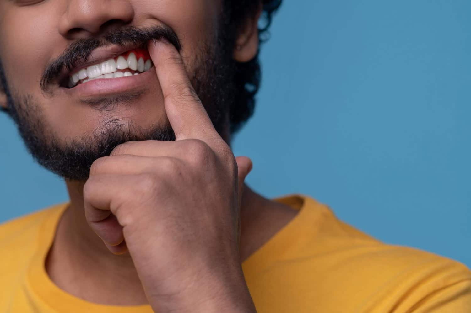 Les pires aliments qui endommagent vos dents
