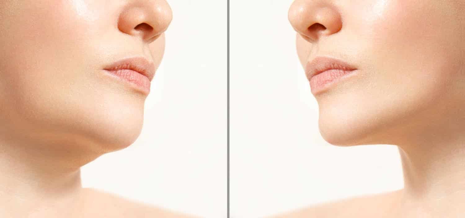 7 astuces pour réduire la graisse du visage et l’affiner