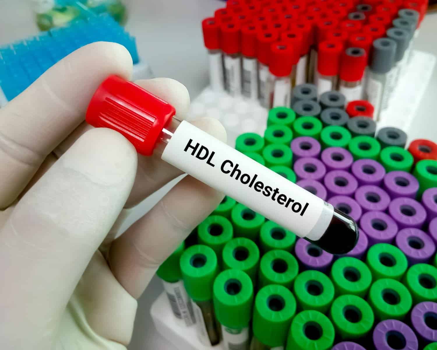 Taux de cholestérol limite : quelles conséquences et que faire ?