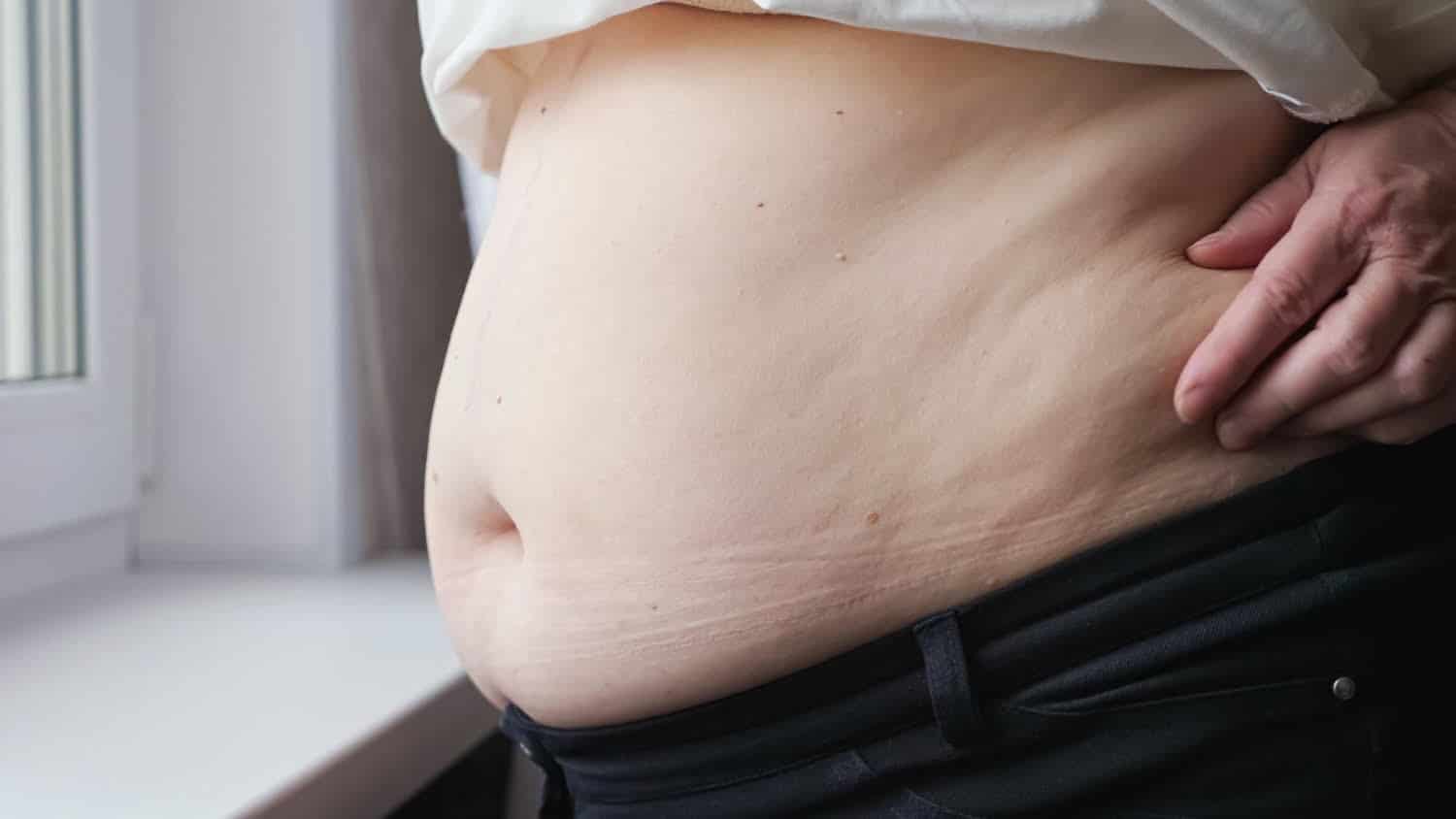 Graisse brune : cette graisse « cachée » qui protège le cœur des personnes obèses