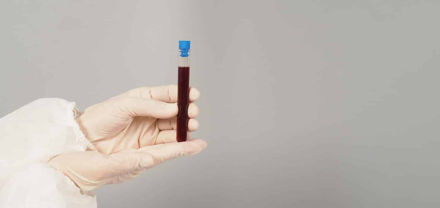 Quel devrait être mon taux de cholestérol à mon âge ?