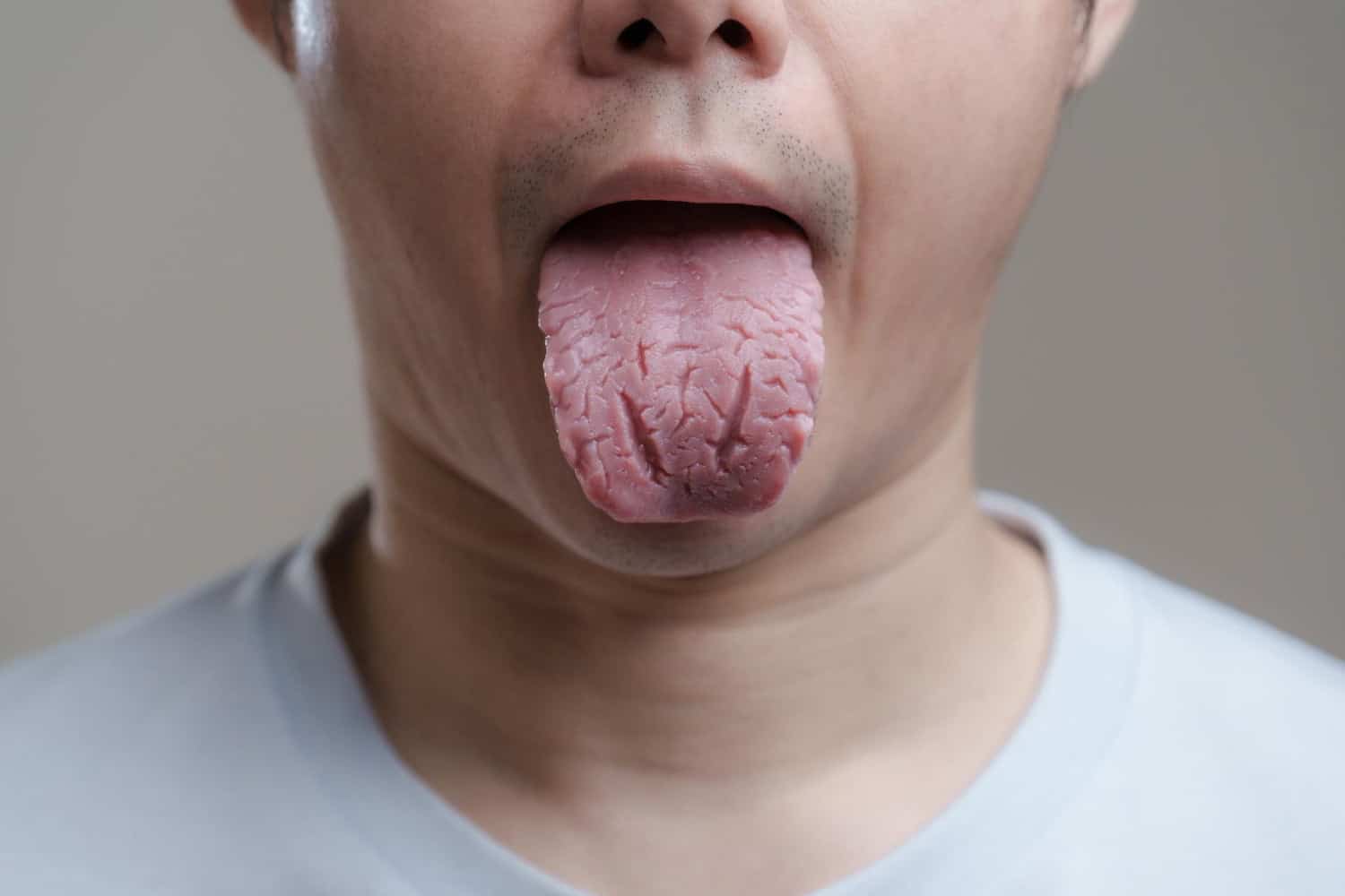 Apaiser une brûlure à la langue : 9 solutions