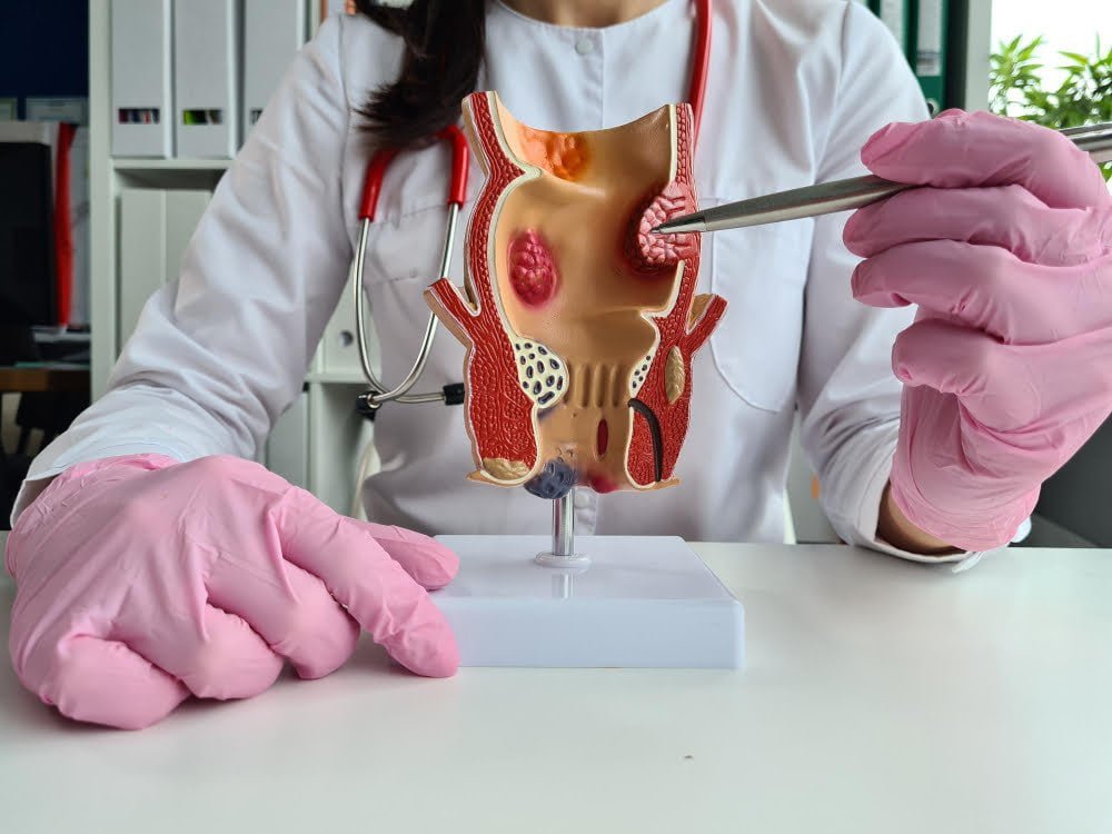 Les symptômes d’un cancer du côlon qui doivent vous alerter