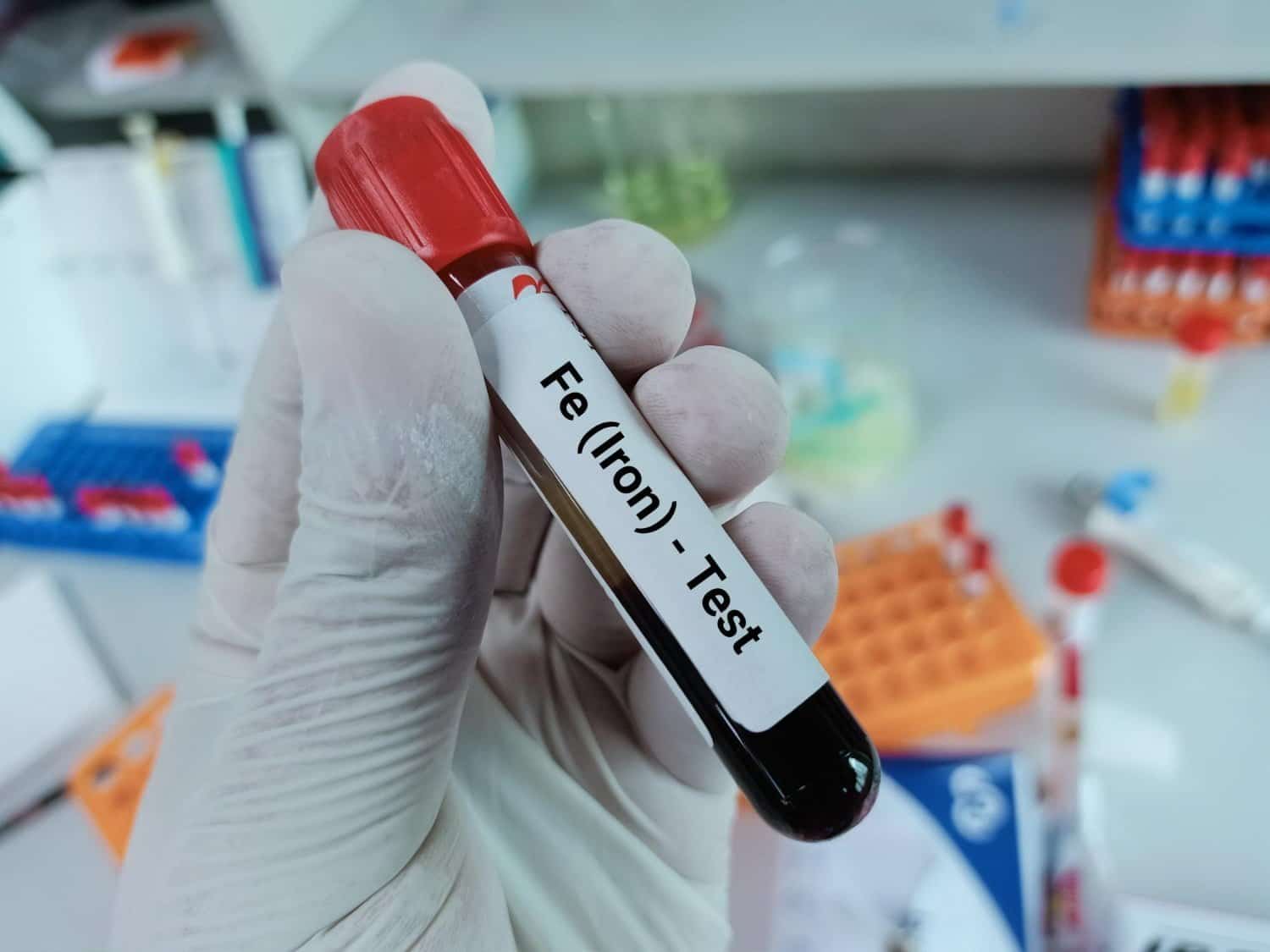 Hémochromatose : Un régime pauvre en fer peut être utile.