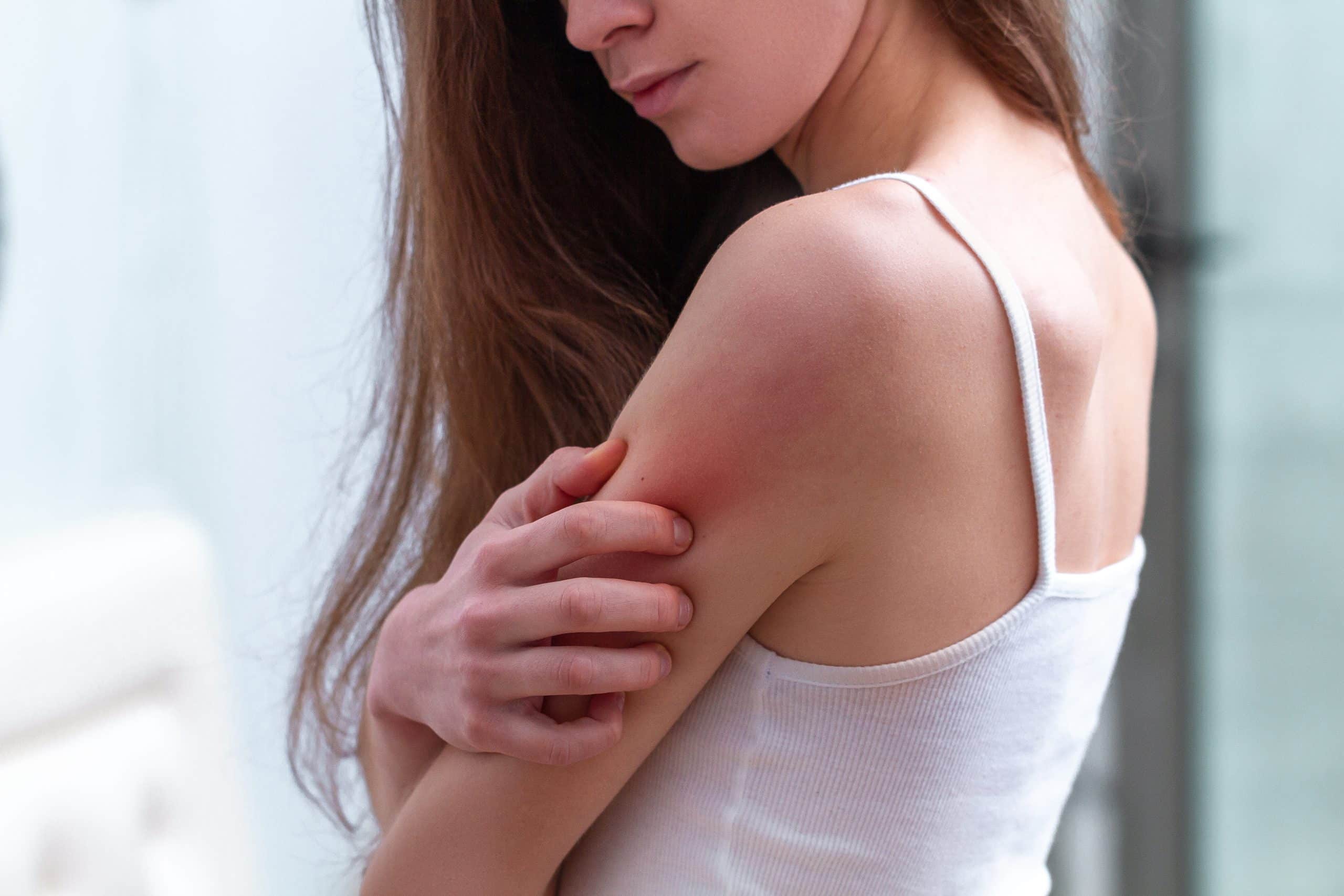 Dermatite, psoriasis, eczéma, … Choisissez le vêtement approprié