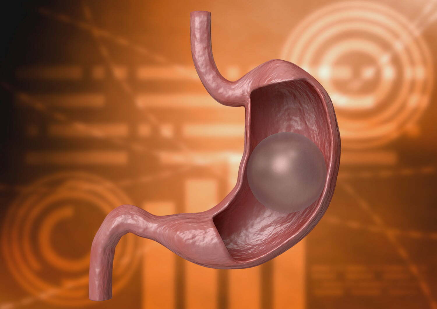 Ballon gastrique, alimentation saine, exercice modéré, … Le trio minceur parfait du programme Allurion