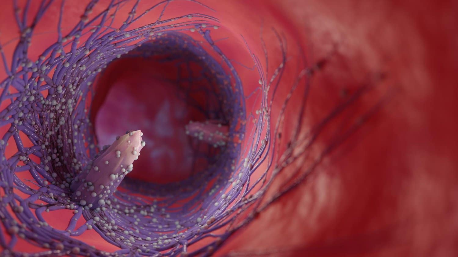 Les principaux signes et symptômes du cancer du rectum à ne pas rater
