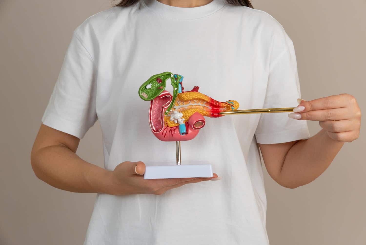 Ablation de la vésicule biliaire : comment bien vivre sans elle ?