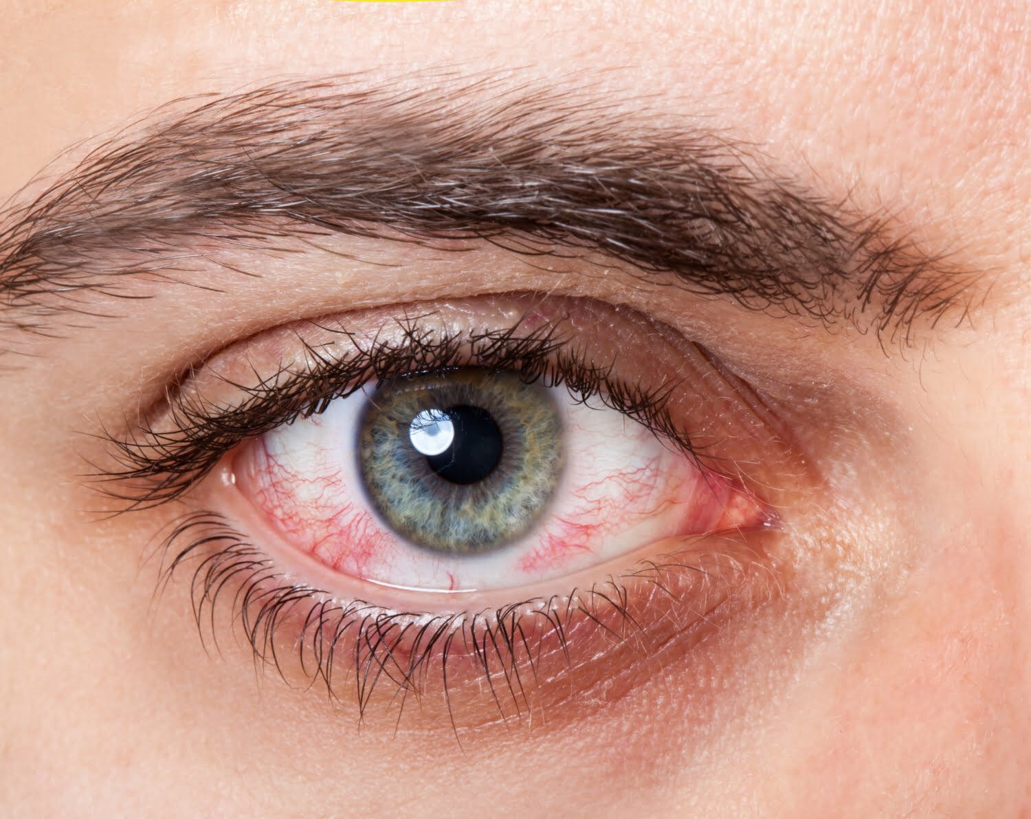 Quels risques pour la santé peut indiquer la couleur de vos yeux