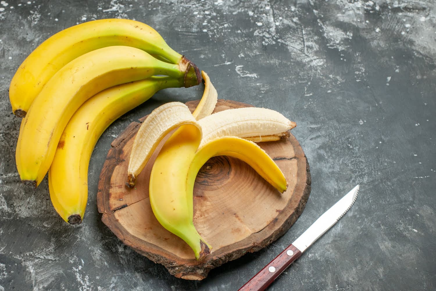 L’astuce de la peau de banane pour éliminer les verrues, comment vous y prendre?