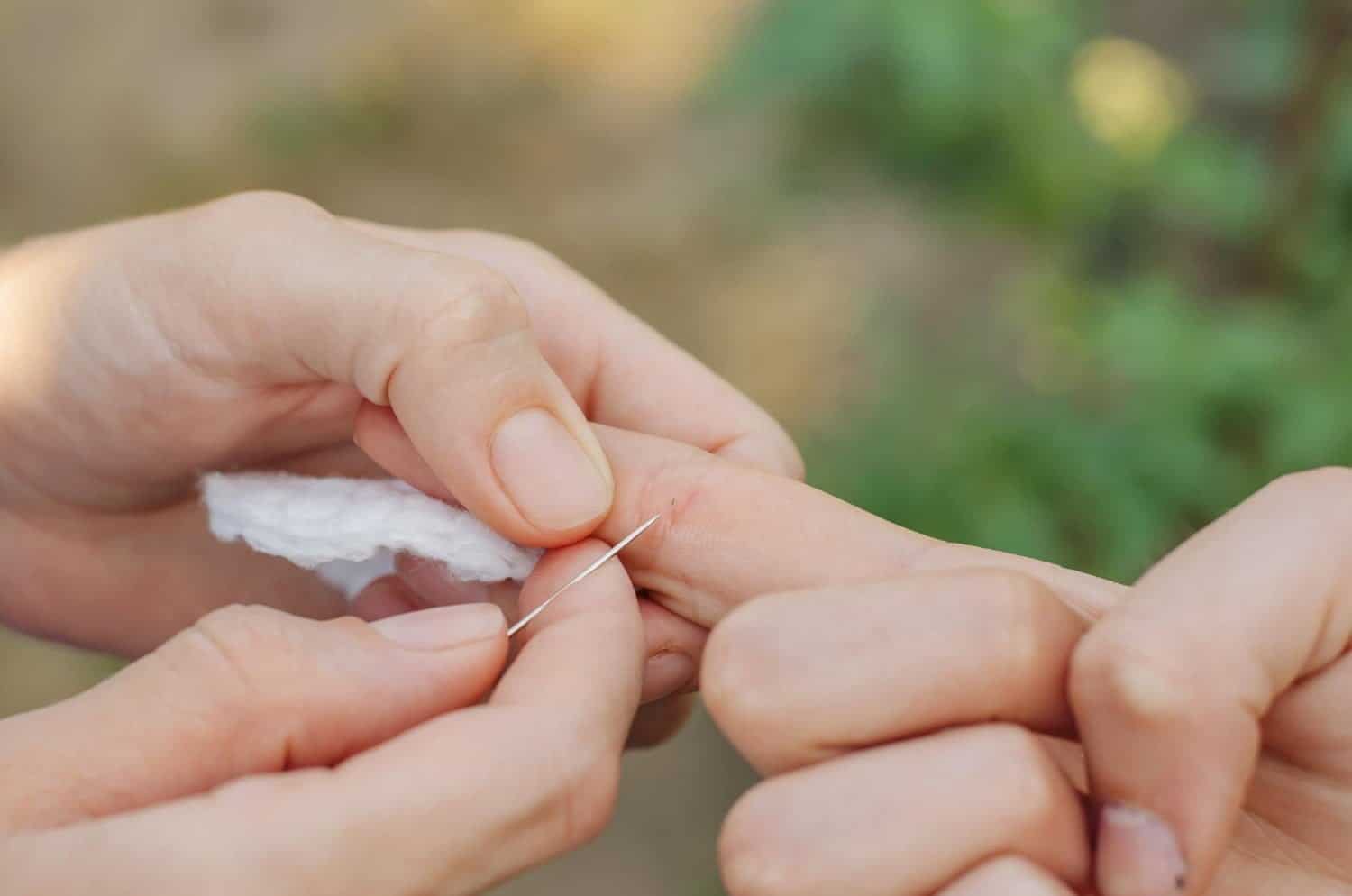 5 astuces pour enlever une écharde