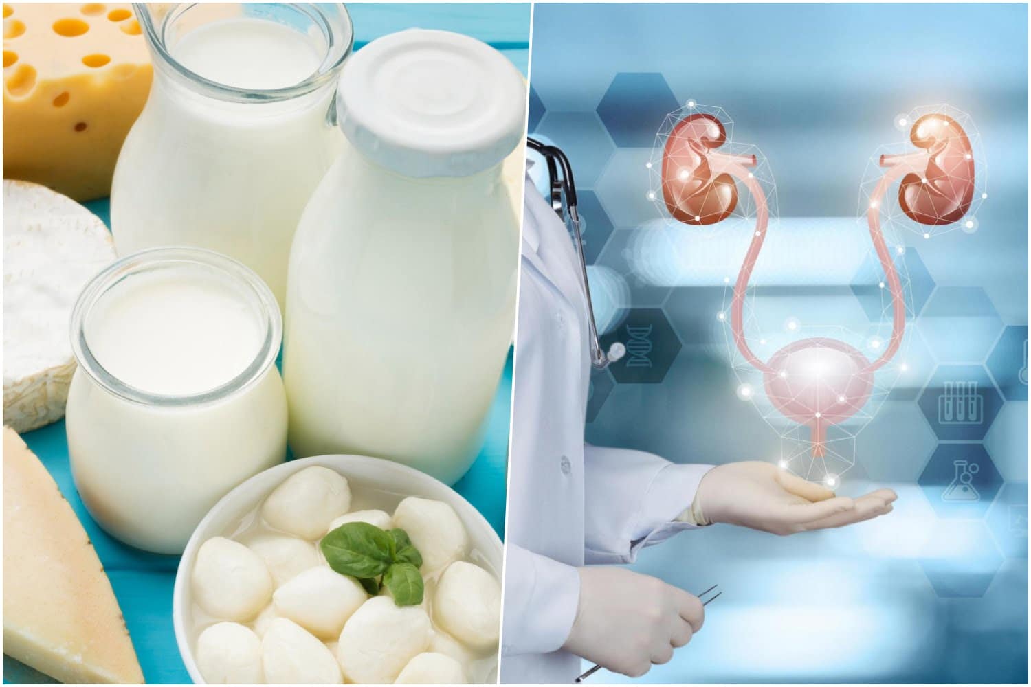Lait, produits laitiers et le cancer de la prostate: une liaison dangereuse