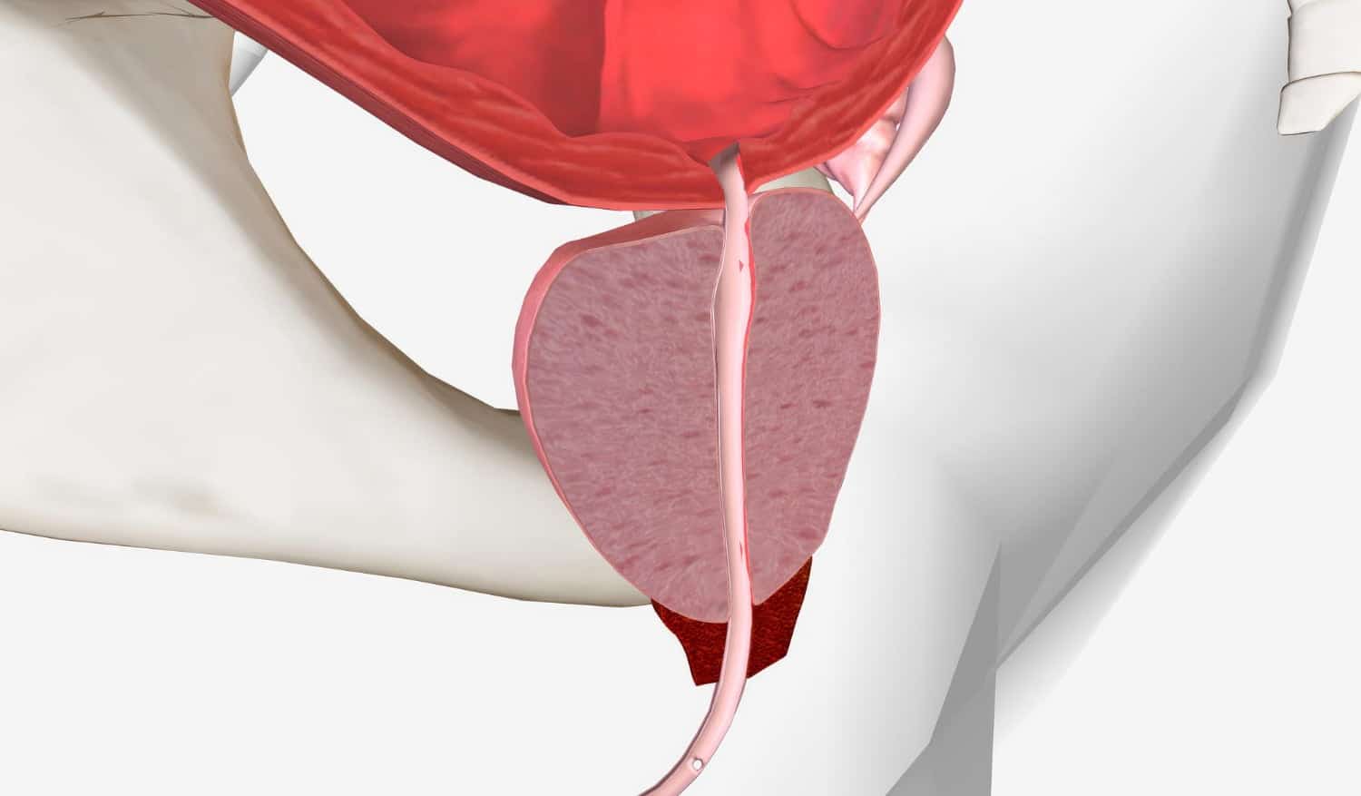 Prostate qui grossit : symptômes, causes, traitement et prévention