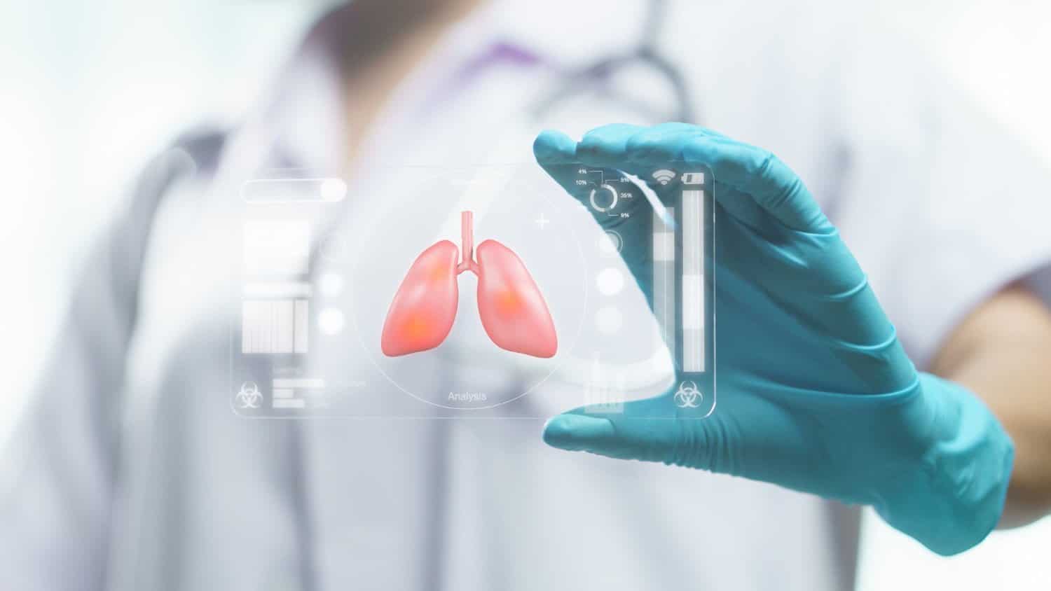 Cancer du poumon : comprendre les causes, les risques et les mesures de prévention